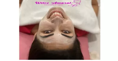Tratamentos Faciais